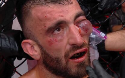 Escalofriante lesión en UFC Abu Dhabi: Mohammad Yahya quedó con un ojo a punto de explotar y pararon su pelea con Steven Nguyen