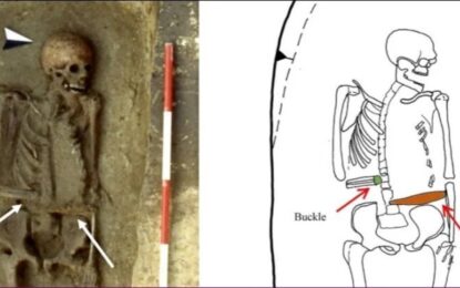 Sorpresa con los restos de un hombre medieval: reemplazó su mano amputada con un cuchillo