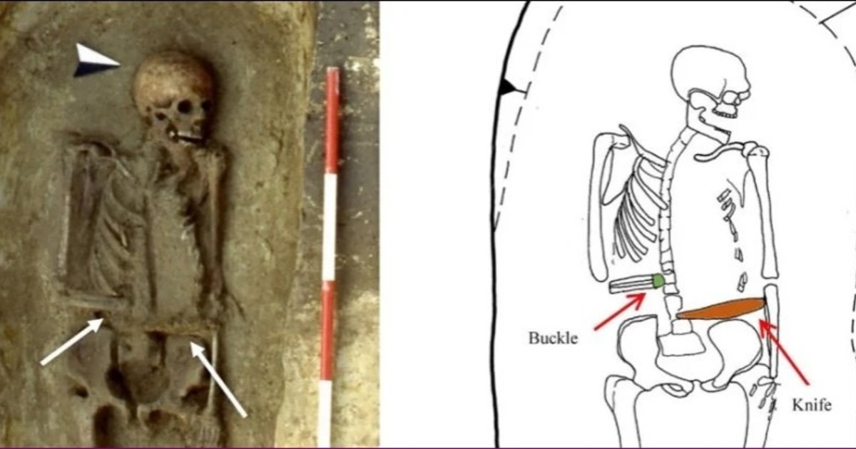 sorpresa-con-los-restos-de-un-hombre-medieval:-reemplazo-su-mano-amputada-con-un-cuchillo