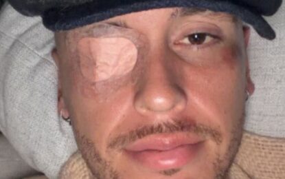 El delicado momento de salud de Lucas Ocampos: tras fracturarse, sufrió una parálisis facial y se pierde la pretemporada en México