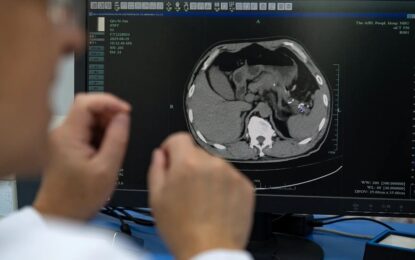 En China, la IA está detectando tumores mortales que los médicos podrían pasar por alto