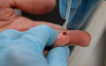 Una gota de sangre de la yema del dedo  serviría para detectar el alzhéimer
