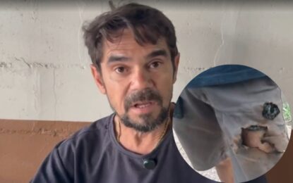 Sufrió el ataque de dos perros en la calle y su teléfono le explotó en la pierna: «Fue peligroso, pero eso me salvó»