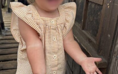 “Es la peor pesadilla de cualquier padre”: una beba de 2 años fue diagnosticada con una rara demencia infantil
