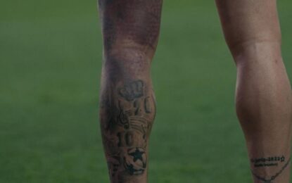 La impactante imagen del moretón de Rodrigo De Paul: ¿llega al amistoso de la Selección en la Bombonera?