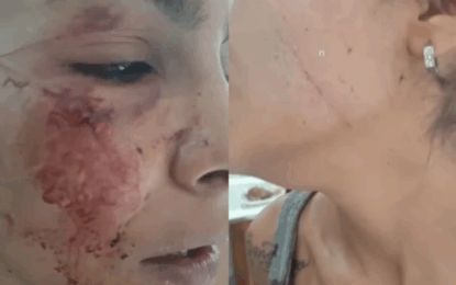 Mar del Plata: la acusaron de estar con el marido de una de sus amigas y la golpearon brutalmente