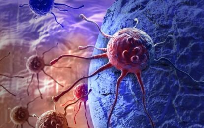 Los científicos descubren que los tumores cancerosos son «adictos» a este antioxidante común