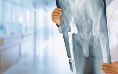 Un fármaco experimental puede revertir la osteoartritis en semanas, según demuestran estudios en animales